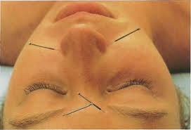 Acupunctura